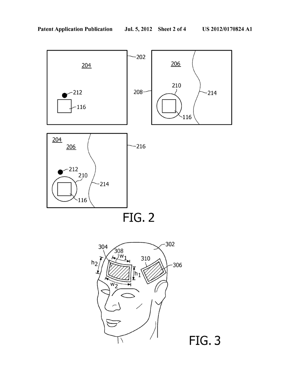 SYSTEM FOR DETECTING GLOBAL PATIENT MOVEMENT DURING IMAGING PROCEDURES - diagram, schematic, and image 03