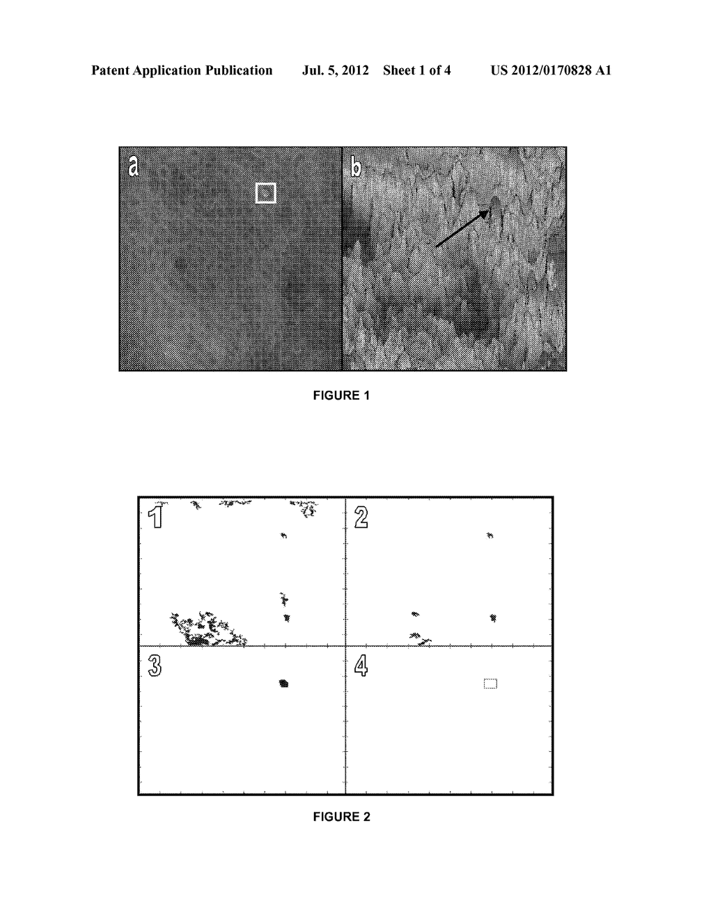 AUTOMATED DETECTION OF MELANOMA - diagram, schematic, and image 02