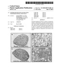 METHOD FOR TREATING PANCREATITIS WITH MESENCHYMAL STEM CELLS diagram and image