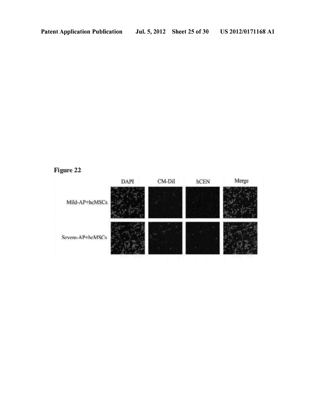 METHOD FOR TREATING PANCREATITIS WITH MESENCHYMAL STEM CELLS - diagram, schematic, and image 26