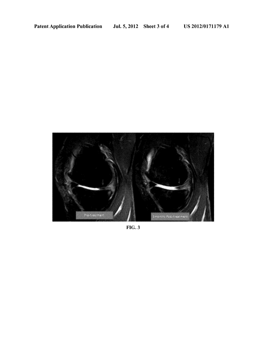 APPARATUS, SYSTEM, AND METHOD FOR COMPOSITIONS AND METHODS FOR TREATING,     PREVENTING, OR ALLEVIATING BONE OR CARTILAGE DISEASES - diagram, schematic, and image 04