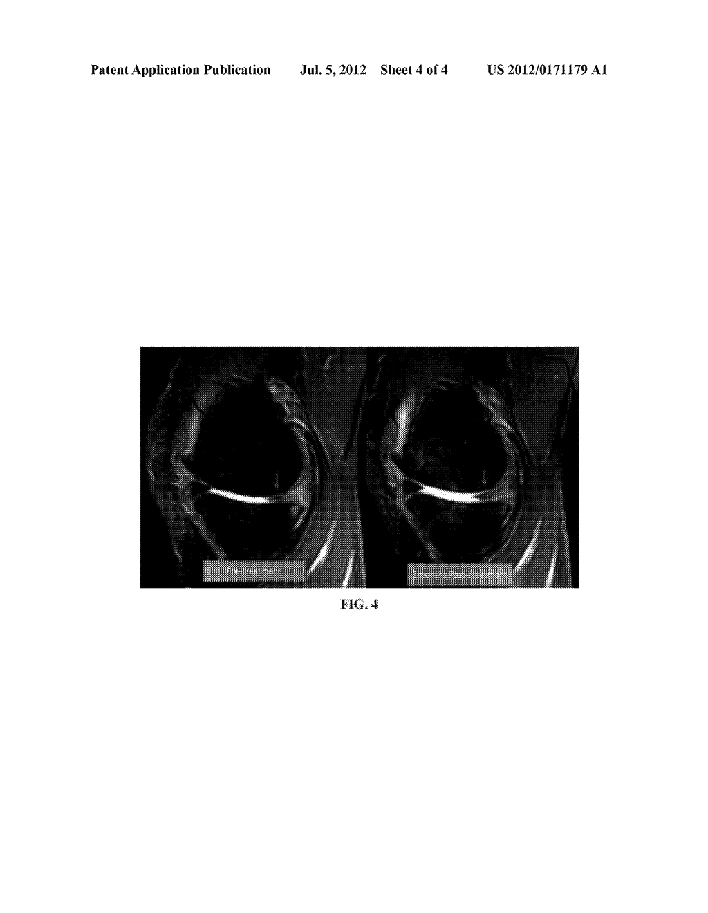 APPARATUS, SYSTEM, AND METHOD FOR COMPOSITIONS AND METHODS FOR TREATING,     PREVENTING, OR ALLEVIATING BONE OR CARTILAGE DISEASES - diagram, schematic, and image 05