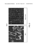 COMPOSITIONS COMPRISING AMNION DERIVED ADHERENT CELLS AND PLATELET-RICH     PLASMA diagram and image