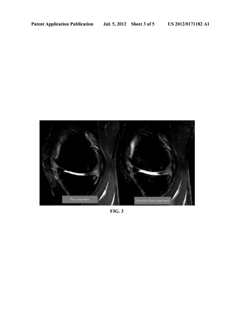 METHODS AND COMPOSITIONS FOR THE TREATMENT, PREVENTION, AND ALLEVIATION OF     BONE AND CARTILAGE DISEASES OR INJURIES AND HAIR LOSS - diagram, schematic, and image 04