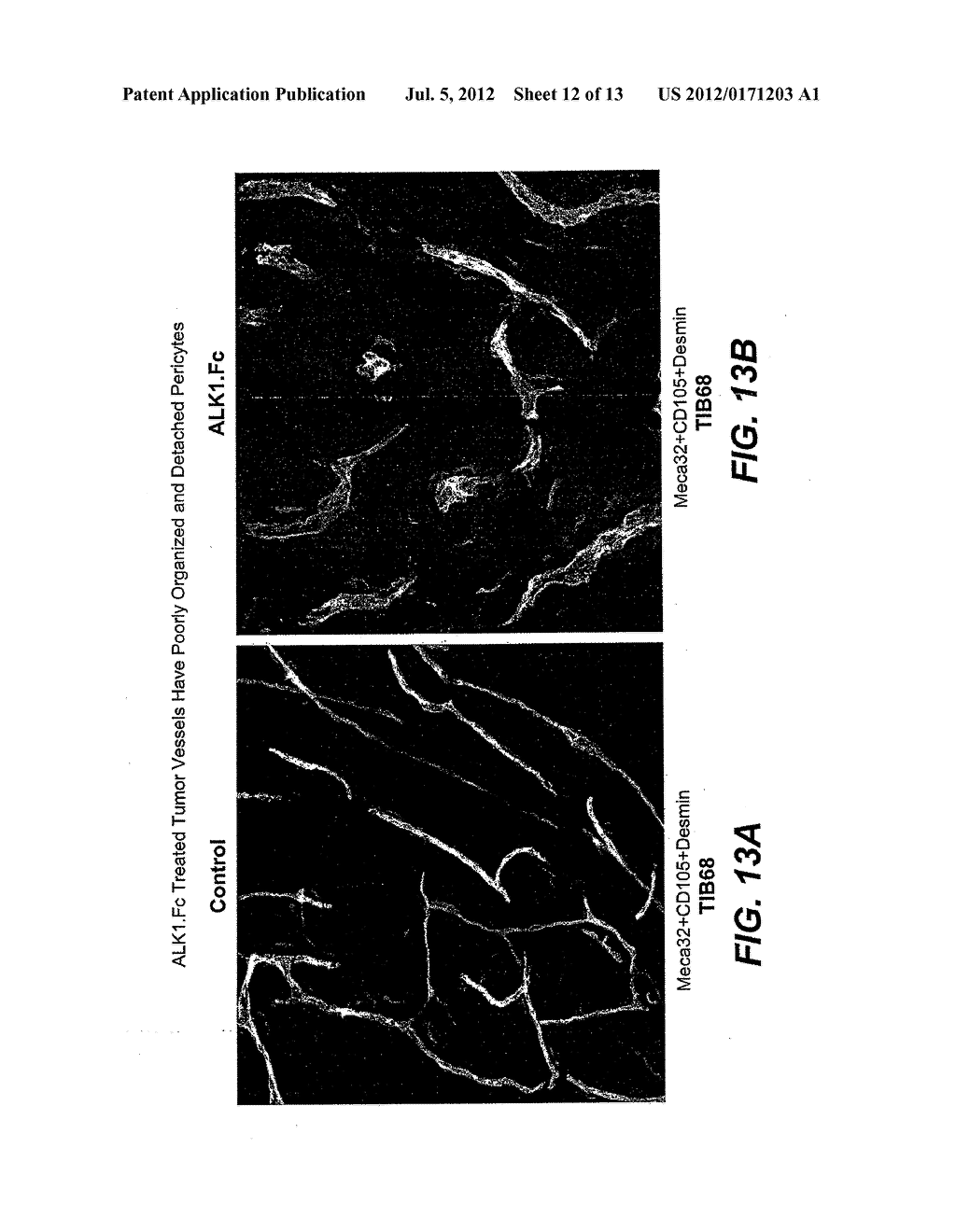 ACTIVIN RECEPTOR-LIKE KINASE-1 COMPOSITIONS AND METHODS OF USE - diagram, schematic, and image 13