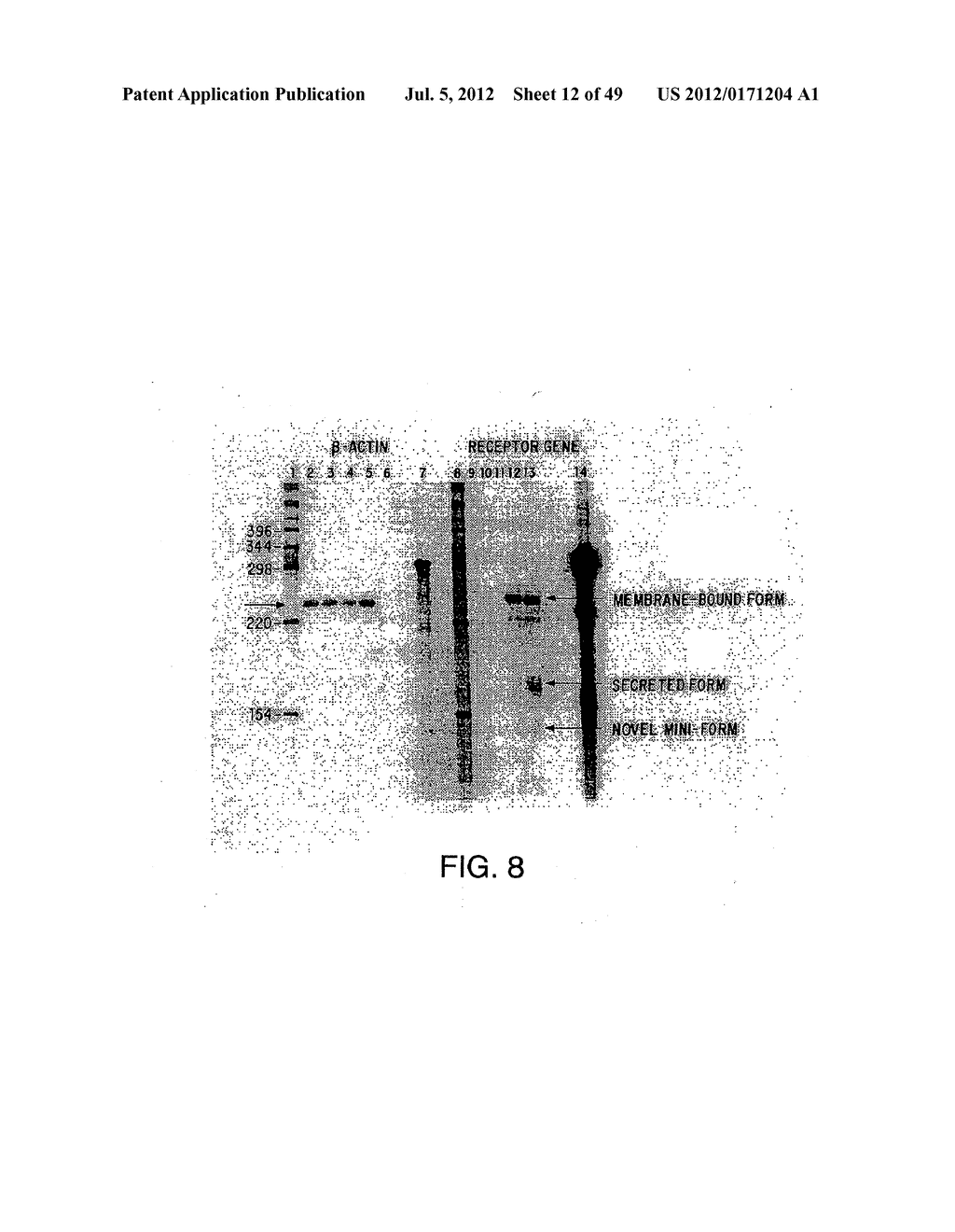 COMPOSITIONS AND METHODS FOR THE TREATMENT AND DIAGNOSIS OF IMMUNE     DISORDERS - diagram, schematic, and image 13