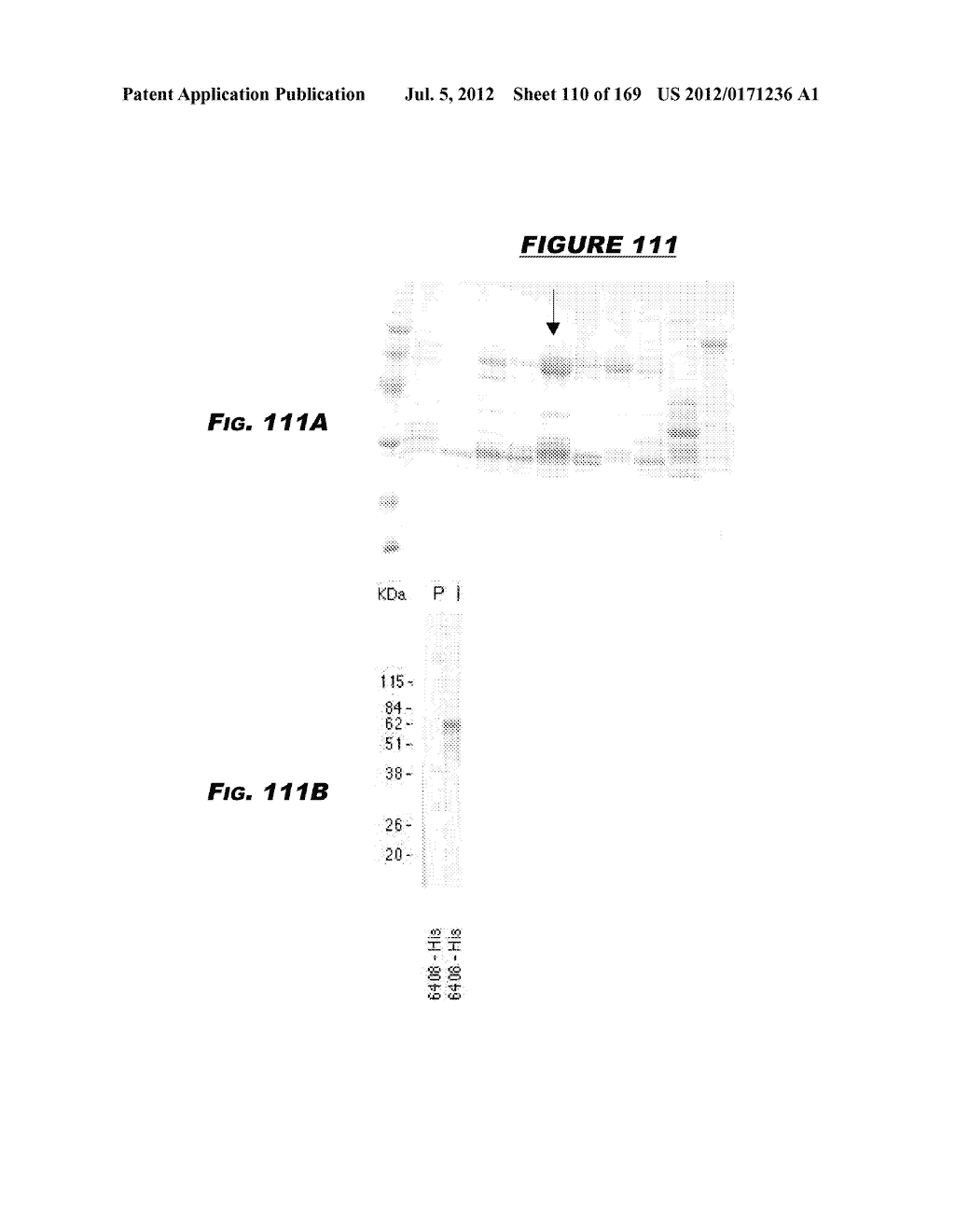 IMMUNIZATION AGAINST CHLAMYDIA PNEUMONIAE - diagram, schematic, and image 111