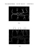 IMAGE ANALYSIS METHOD diagram and image