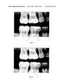 IMAGE ANALYSIS METHOD diagram and image