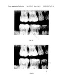 IMAGE ANALYSIS METHOD diagram and image