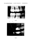 IMAGE ANALYSIS METHOD diagram and image