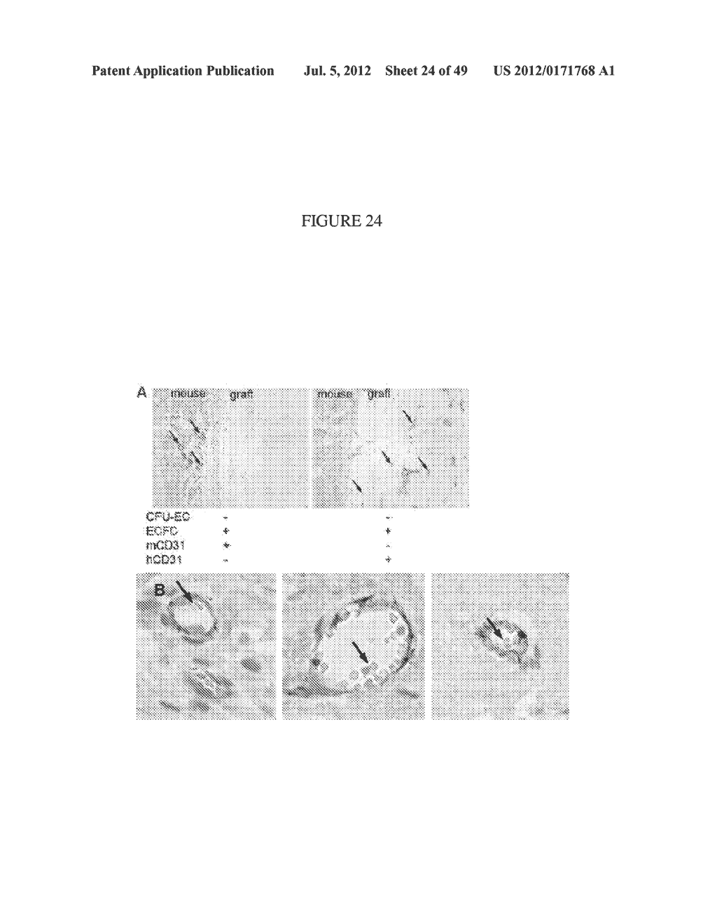 COLLAGEN-BASED MATRICES FOR VESSEL DENSITY AND SIZE REGULATION - diagram, schematic, and image 25