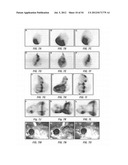 ANTIBODIES THAT SPECIFICALLY BIND HEDGEHOG-DERIVED POLYPEPTIDES diagram and image