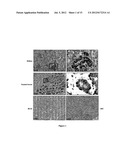 Klotho Protein and Related Compounds for the Treatment and Diagnosis of     Cancer diagram and image