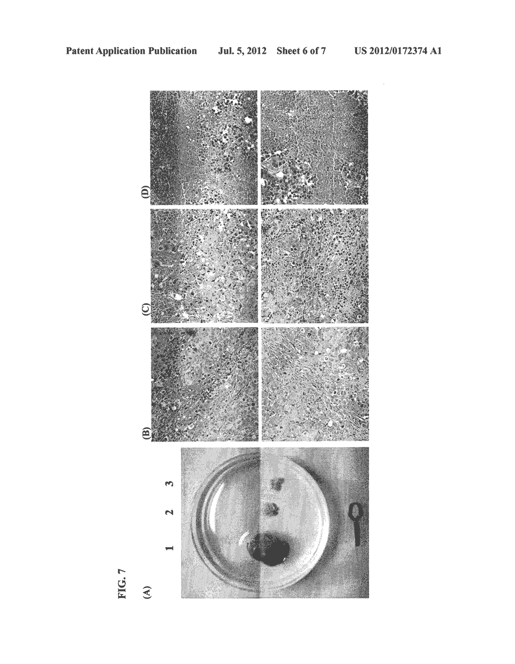 NOVEL TUBULIN INHIBITORS AND METHODS OF USING THE SAME - diagram, schematic, and image 07