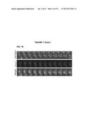 PROCESS FOR THE IDENTIFICATION OF COMPOUNDS FOR TREATING CANCER diagram and image