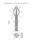 Apparatus and Method for providing a Double Balloon Breast Brachytherapy     Device diagram and image