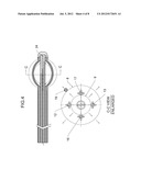 Apparatus and Method for providing a Double Balloon Breast Brachytherapy     Device diagram and image