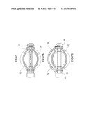 Apparatus and Method for providing a Double Balloon Breast Brachytherapy     Device diagram and image