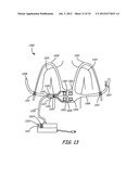 THERMALLY ASSISTED PULSED ELECTRO-MAGNETIC FIELD STIMULATION DEVICE AND     METHOD FOR TREATMENT OF OSTEOARTHRITIS diagram and image