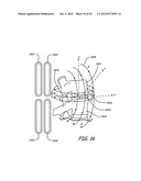 THERMALLY ASSISTED PULSED ELECTRO-MAGNETIC FIELD STIMULATION DEVICE AND     METHOD FOR TREATMENT OF OSTEOARTHRITIS diagram and image