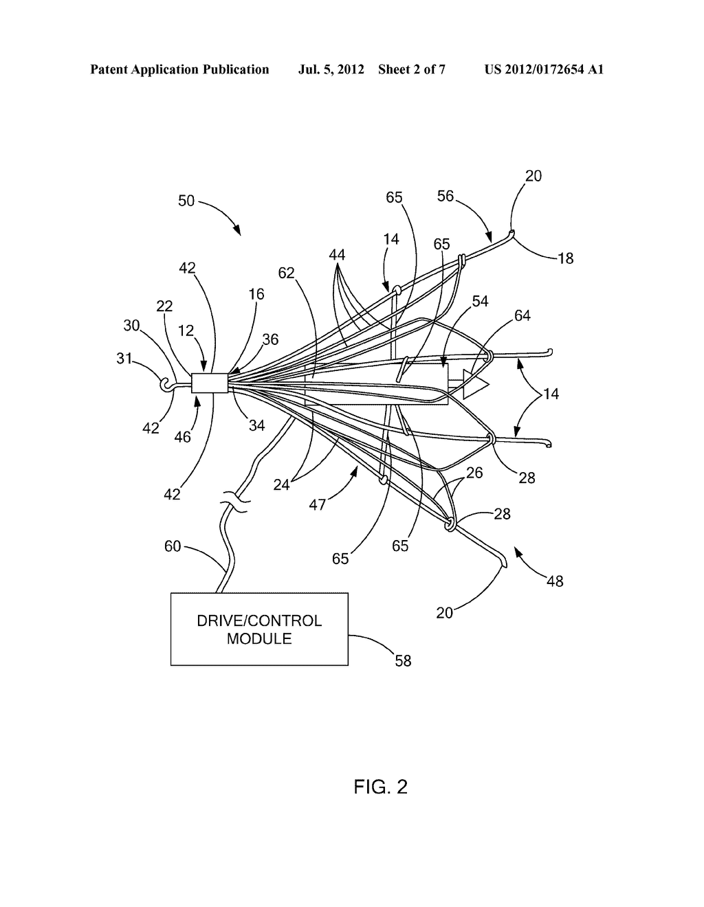 VENTRICULAR ASSIST DEVICE - diagram, schematic, and image 03