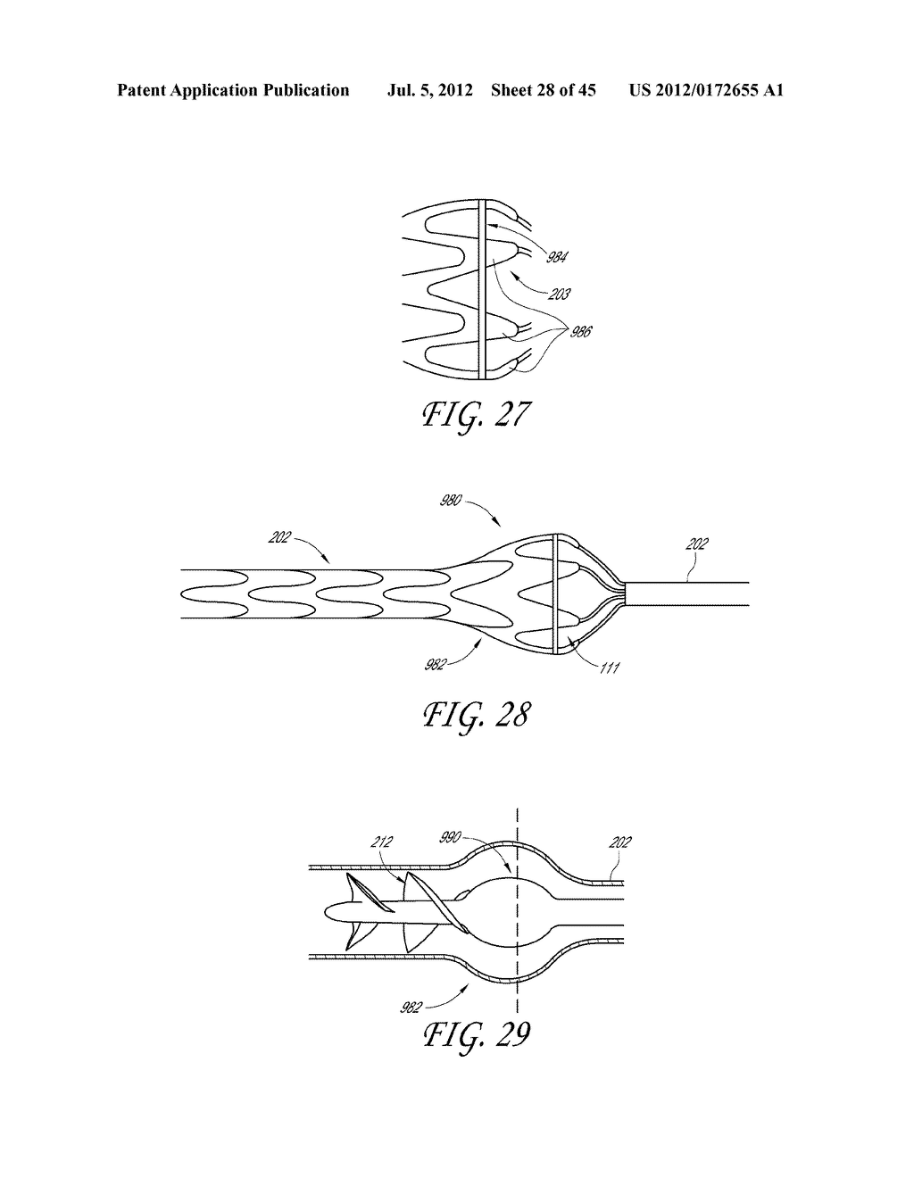 IMPELLER HOUSING FOR PERCUTANEOUS HEART PUMP - diagram, schematic, and image 29