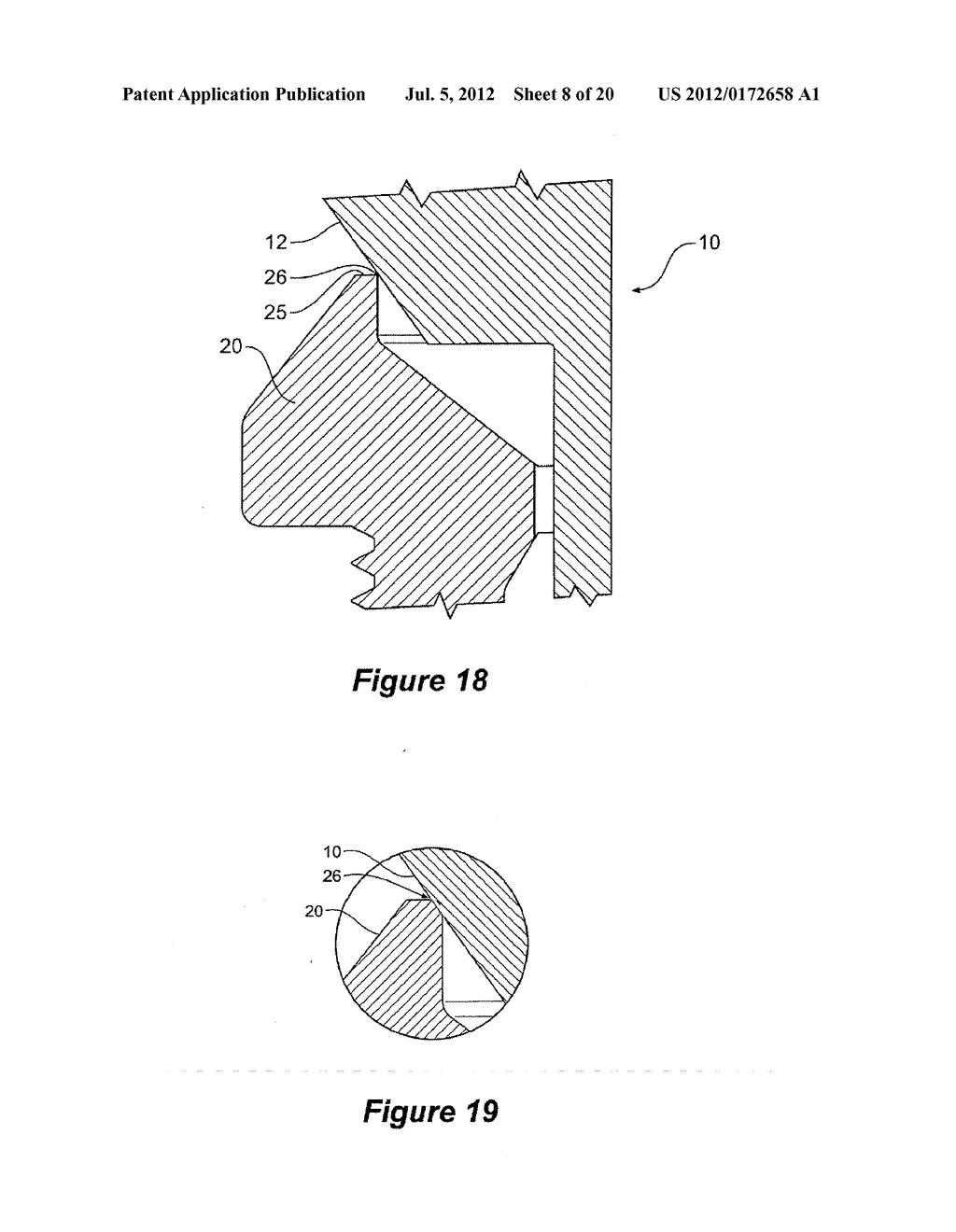 MEDICAL IMPLANT SYSTEM - diagram, schematic, and image 09