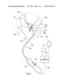 METHOD FOR SYMPATHETIC REBALANCING OF PATIENT diagram and image