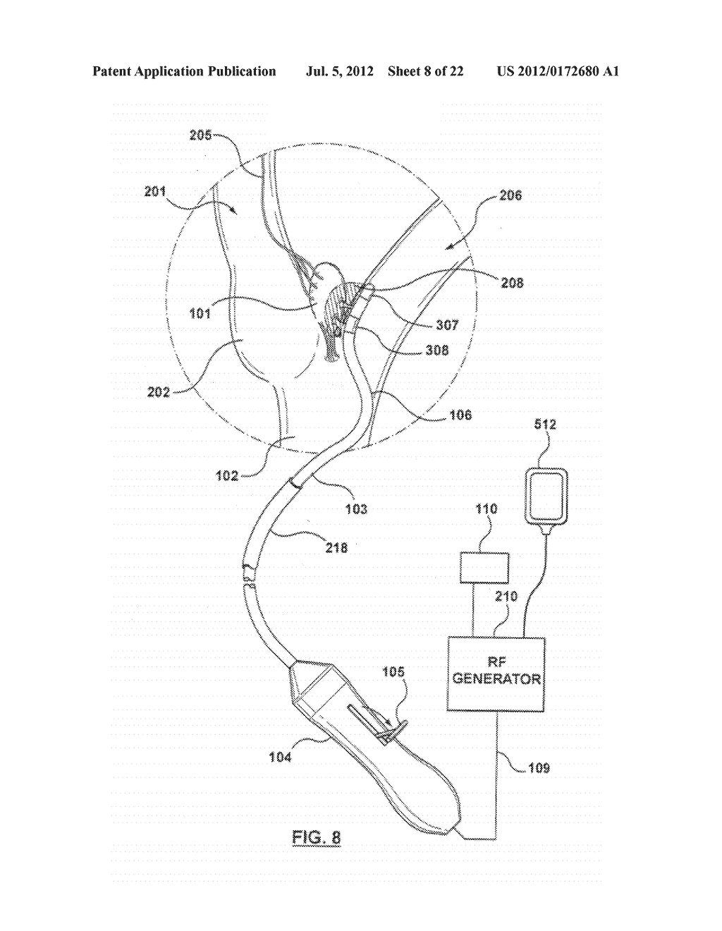 METHOD FOR SYMPATHETIC REBALANCING OF PATIENT - diagram, schematic, and image 09