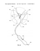 METHOD FOR SYMPATHETIC REBALANCING OF PATIENT diagram and image