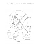 METHOD FOR SYMPATHETIC REBALANCING OF PATIENT diagram and image