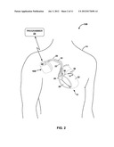 IMPLANTABLE MEDICAL DEVICE FIXATION diagram and image