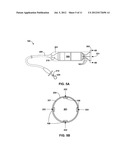 IMPLANTABLE MEDICAL DEVICE FIXATION diagram and image