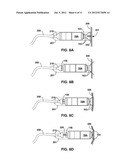 IMPLANTABLE MEDICAL DEVICE FIXATION diagram and image