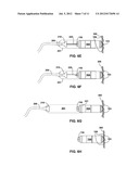 IMPLANTABLE MEDICAL DEVICE FIXATION diagram and image