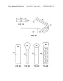 IMPLANTABLE MEDICAL DEVICE FIXATION diagram and image