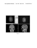 METHOD OF RAPIDLY VISUALIZING ESSENTIAL NEURAL PATHWAYS diagram and image