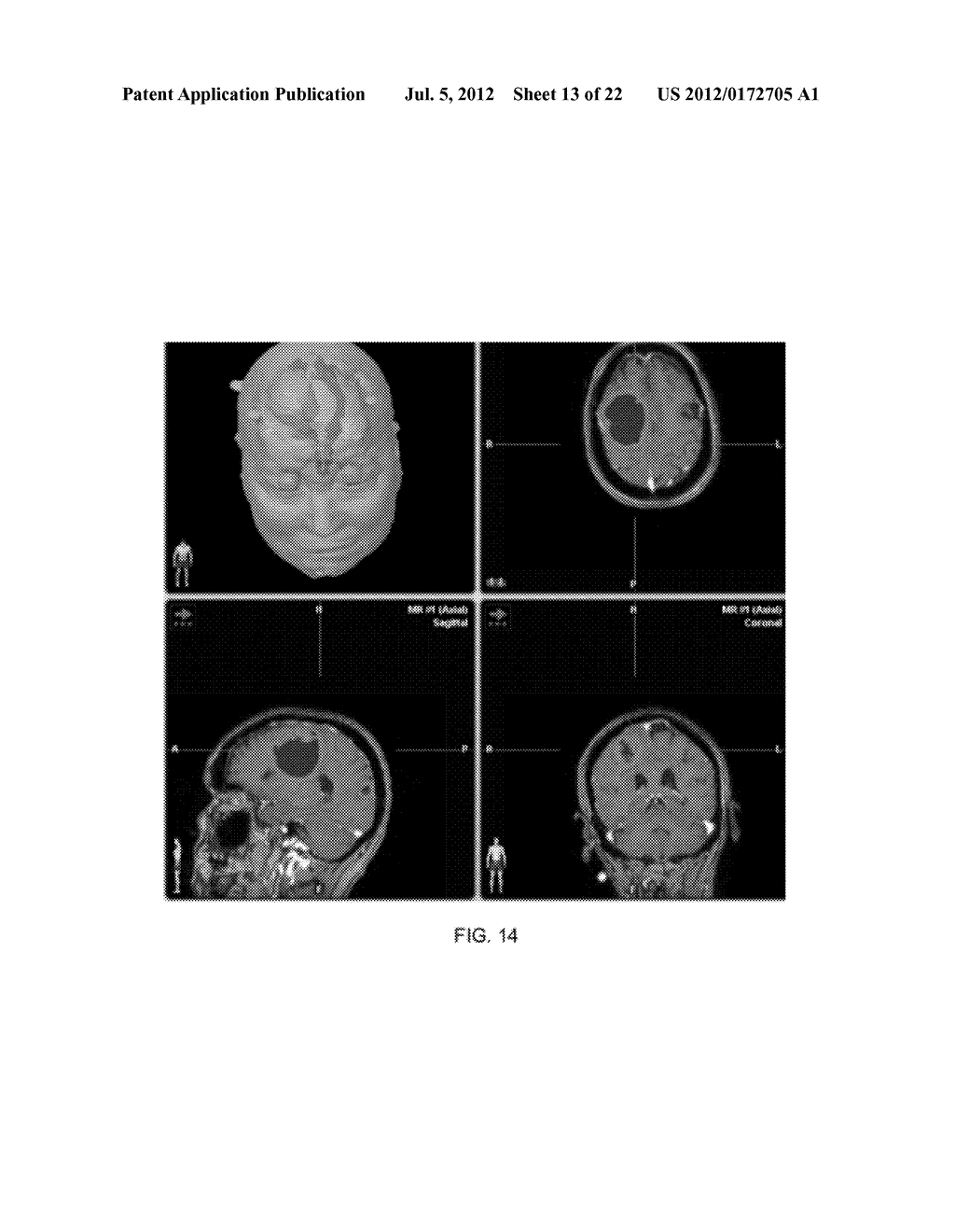 METHOD OF RAPIDLY VISUALIZING ESSENTIAL NEURAL PATHWAYS - diagram, schematic, and image 14