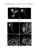 METHOD OF RAPIDLY VISUALIZING ESSENTIAL NEURAL PATHWAYS diagram and image