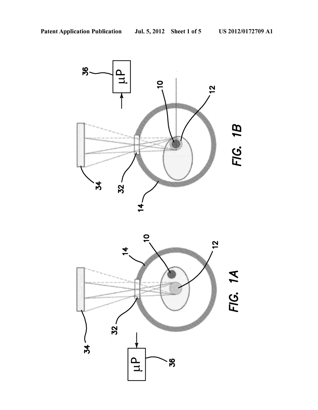 MULTIMODALITY NUCLEAR IMAGING RECONSTRUCTION METHOD - diagram, schematic, and image 02