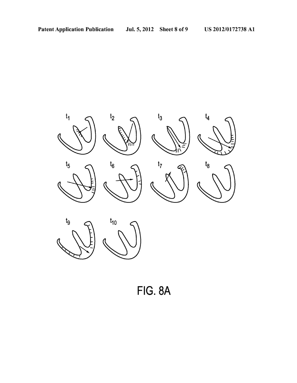 APPARATUS AND METHOD FOR NON-INVASIVE INTRACARDIAC ELECTROCARDIOGRAPHY     USING MPI - diagram, schematic, and image 09