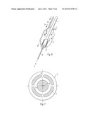 ANTI-CARBONISATION DEVICE diagram and image