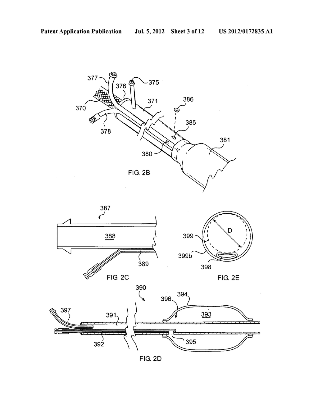 Multi-Conduit Balloon Catheter - diagram, schematic, and image 04