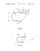 DEVICE HAVING AN ELECTROFORMED PLEATED REGION AND METHOD OF ITS     MANUFACTURE diagram and image