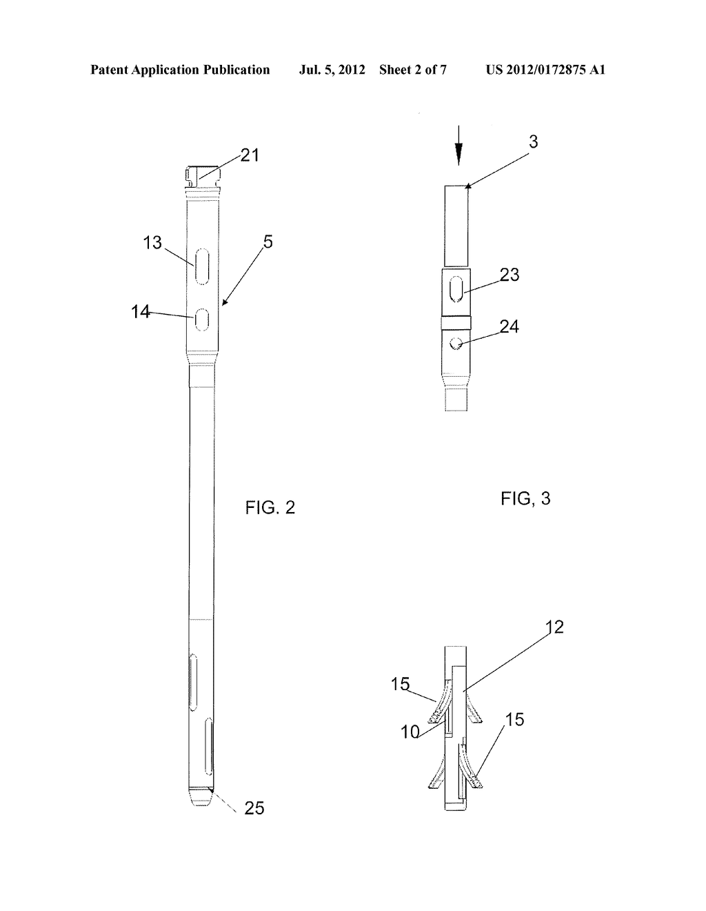 INTRAMEDULLARY NAIL WITH SHAPE MEMORY ELEMENTS FOR ELONGATED BONES - diagram, schematic, and image 03