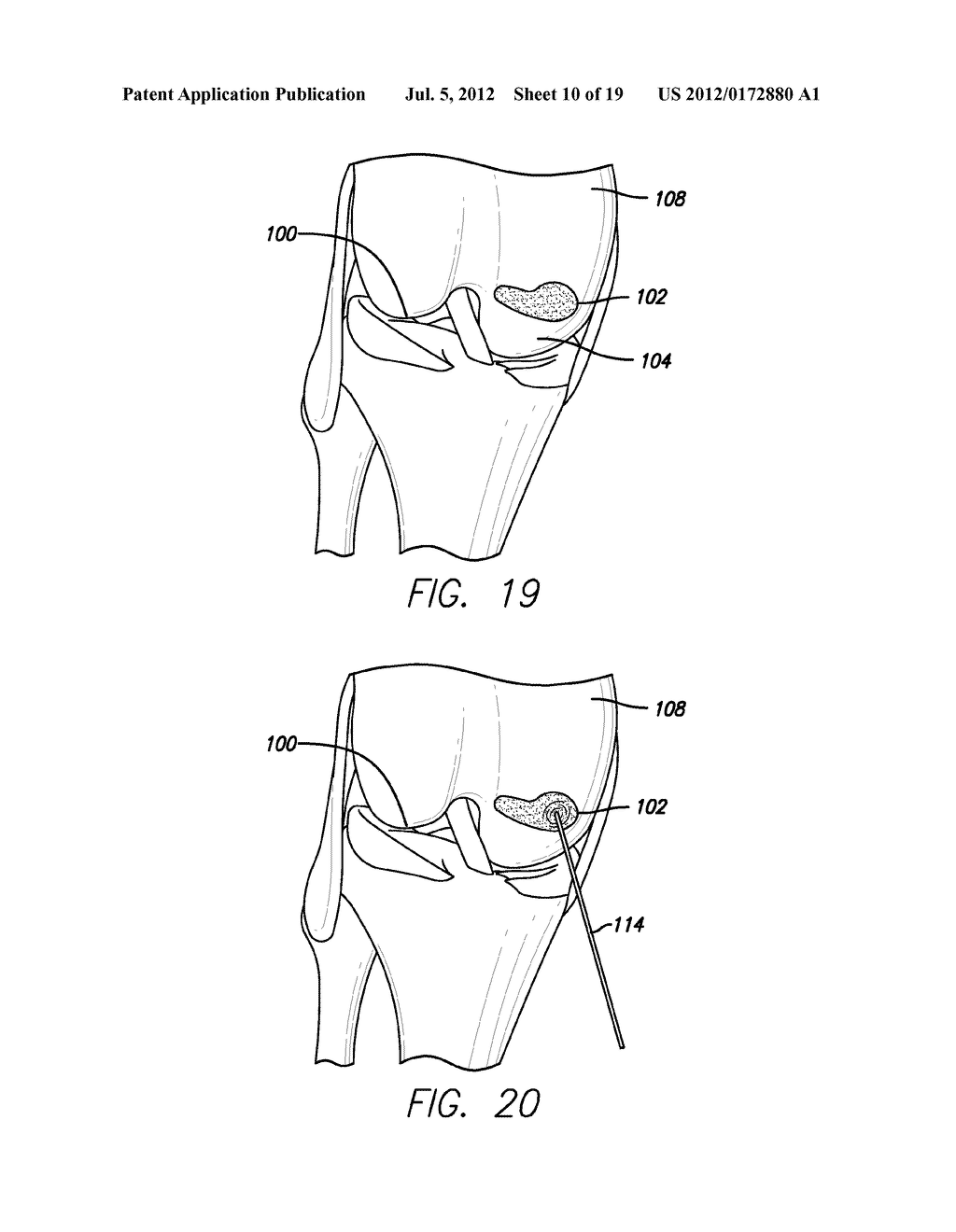 METHOD AND DEVICE FOR AMELIORATING JOINT CONDITIONS AND DISEASES - diagram, schematic, and image 11