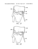 METHOD AND DEVICE FOR AMELIORATING JOINT CONDITIONS AND DISEASES diagram and image