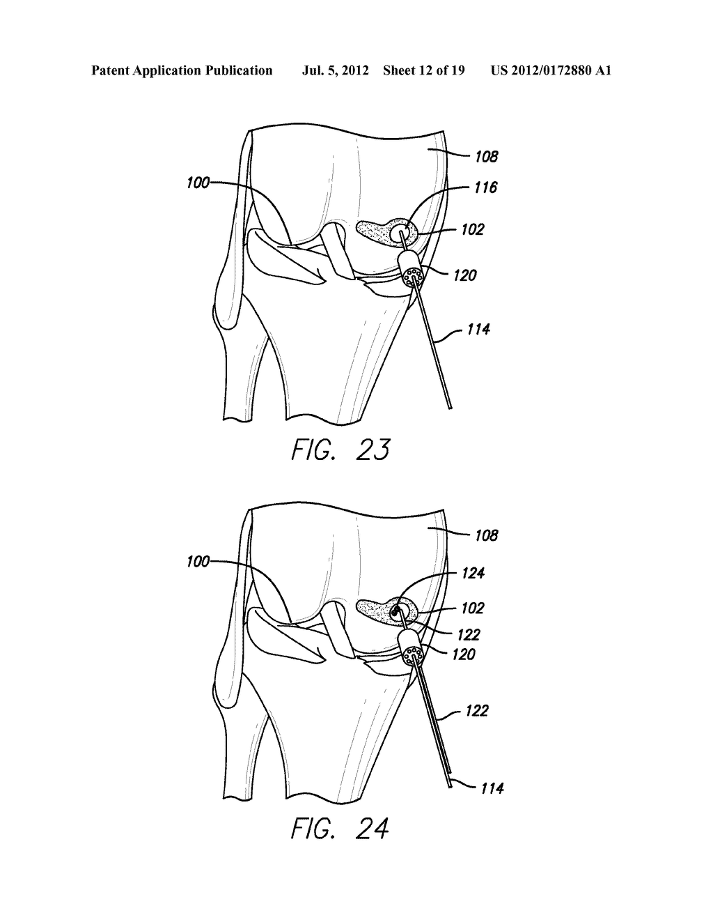 METHOD AND DEVICE FOR AMELIORATING JOINT CONDITIONS AND DISEASES - diagram, schematic, and image 13