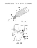 METHOD AND DEVICE FOR AMELIORATING JOINT CONDITIONS AND DISEASES diagram and image